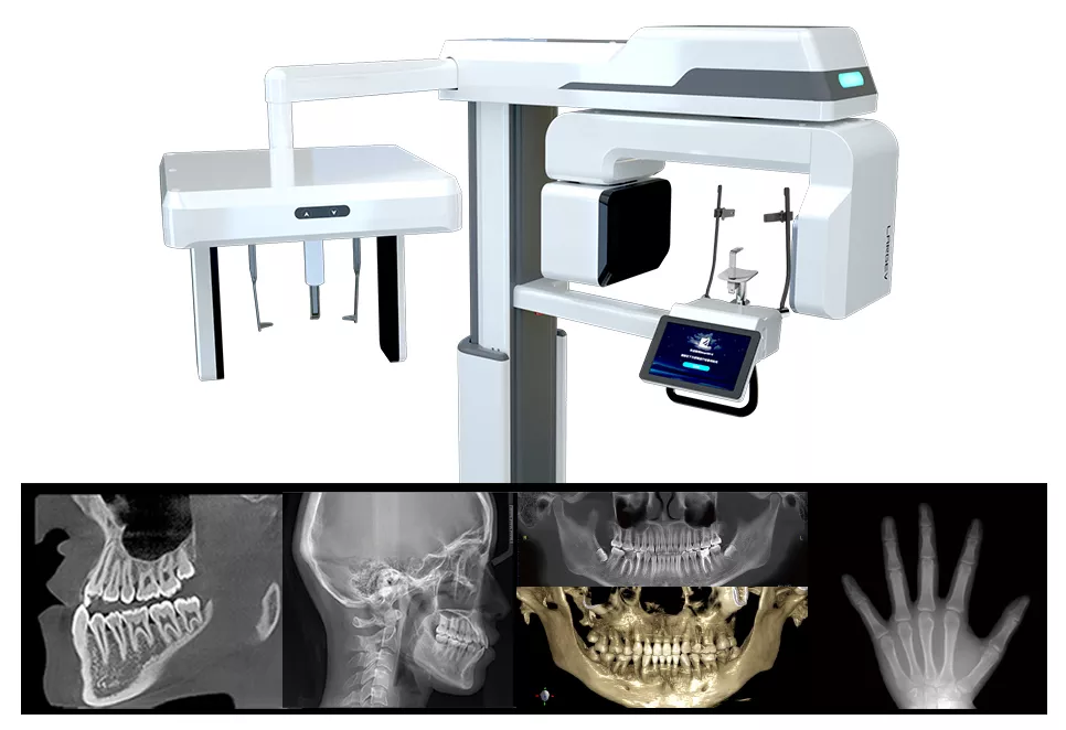 SMART3D-X dental CBCT system and sample scans