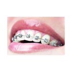 Self-Ligating Bracket Kit - Image 2